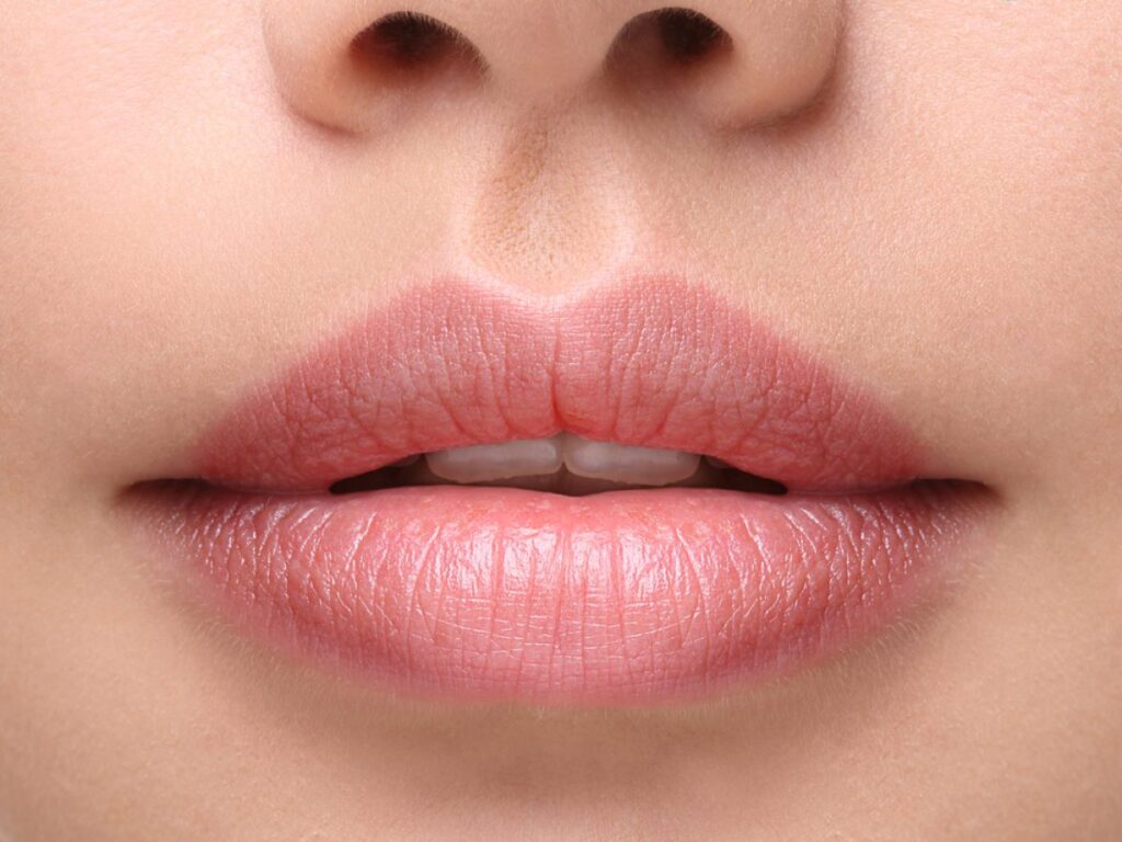 Lip Augmentation Or Lip Enhancement Surgery