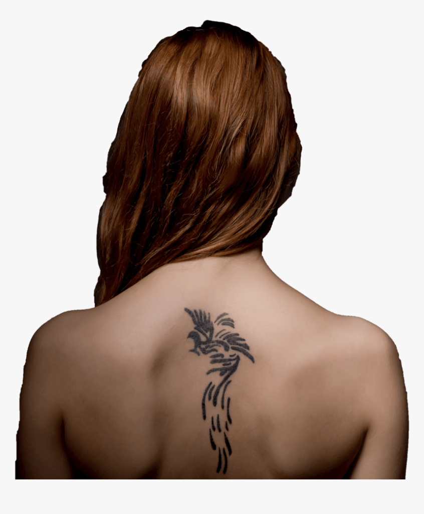 Tattoo Removal Treatment